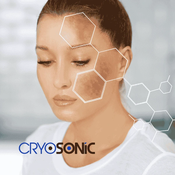 Are you looking for age spot removal treatment? Contact Cryosonic today in Brackley