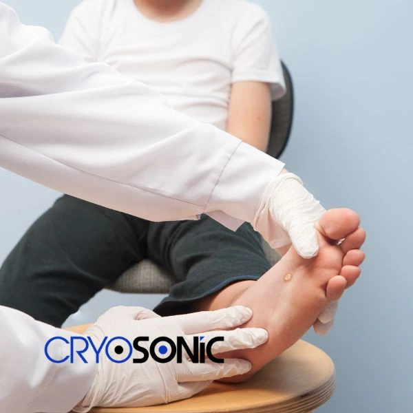 Are you looking for fast effective wart removal Contact us today Brackley