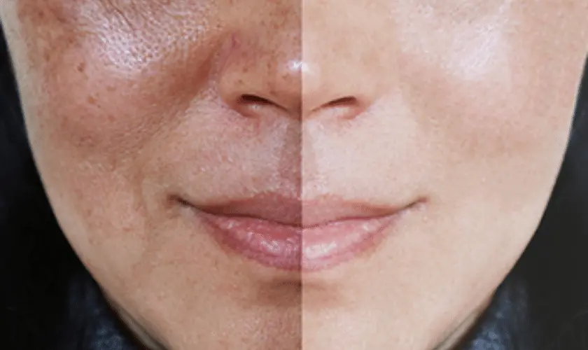 What Lifestyle Changes Support Skin Repair Brackley? Brackley